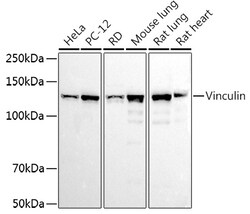 ABclonal Technology&nbsp;Vinculin Rabbit pAb