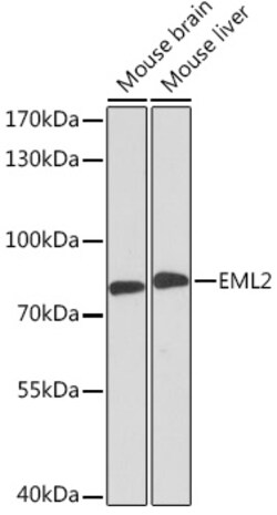ABclonal Technology&nbsp;EML2 Rabbit pAb