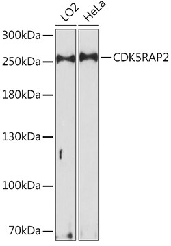 ABclonal Technology&nbsp;CDK5RAP2 Rabbit pAb