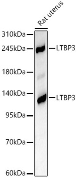 ABclonal Technology&nbsp;LTBP3 Rabbit pAb