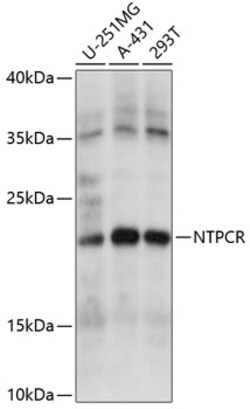 ABclonal Technology&nbsp;NTPCR Rabbit pAb