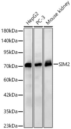 ABclonal Technology&nbsp;SIM2 Rabbit pAb