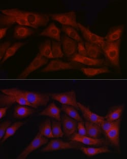 ABclonal Technology&nbsp;TGF beta 1 Rabbit pAb