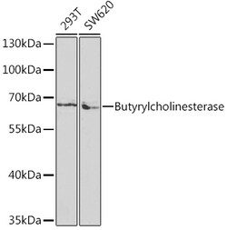 ABclonal Technology&nbsp;Butyrylcholinesterase Rabbit pAb