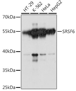 ABclonal Technology&nbsp;SRSF6 Rabbit pAb