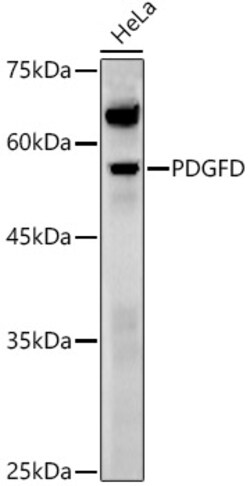 ABclonal Technology&nbsp;PDGFD Rabbit pAb