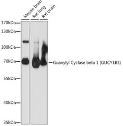 ABclonal Technology&nbsp;Guanylyl Cyclase beta 1 (GUCY1B3) Rabbit pAb