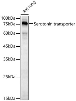 ABclonal Technology&nbsp;Serotonin transporter Rabbit pAb