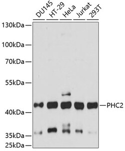 ABclonal Technology&nbsp;PHC2 Rabbit pAb