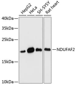 ABclonal Technology&nbsp;NDUFAF2 Rabbit pAb