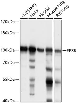 ABclonal Technology&nbsp;EPS8 Rabbit pAb