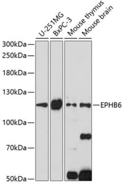 ABclonal Technology&nbsp;EPHB6 Rabbit pAb