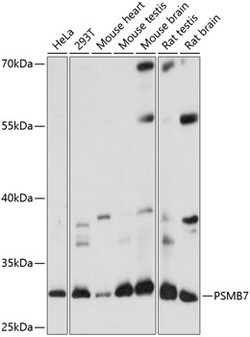 ABclonal Technology&nbsp;PSMB7 Rabbit pAb