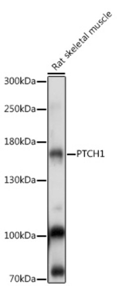 ABclonal Technology&nbsp;PTCH1 Rabbit pAb