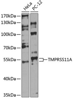 ABclonal Technology&nbsp;TMPRSS11A Rabbit pAb