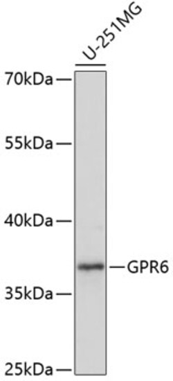 ABclonal Technology&nbsp;GPR6 Rabbit pAb