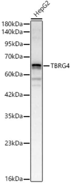 ABclonal Technology&nbsp;TBRG4 Rabbit pAb