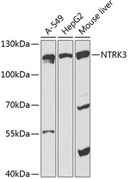 ABclonal Technology&nbsp;TrKC Rabbit pAb