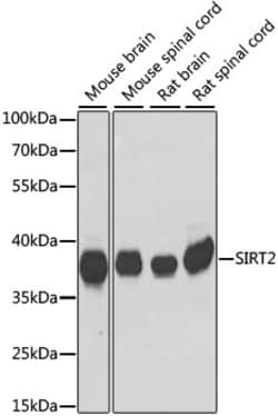 ABclonal Technology&nbsp;SIRT2 Rabbit pAb