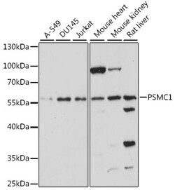 ABclonal Technology&nbsp;PSMC1 Rabbit pAb