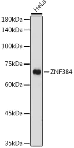 ABclonal Technology&nbsp;ZNF384 Rabbit pAb