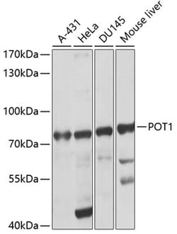 ABclonal Technology&nbsp;POT1 Rabbit pAb