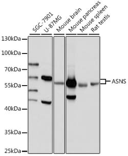 ABclonal Technology&nbsp;ASNS Rabbit pAb