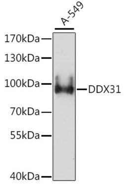 ABclonal Technology&nbsp;DDX31 Rabbit pAb