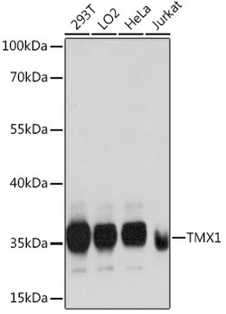 ABclonal Technology&nbsp;TMX1 Rabbit pAb