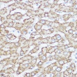 ABclonal Technology&nbsp;NDUFA4 Rabbit pAb