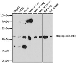 ABclonal Technology&nbsp;Haptoglobin (HP) Rabbit pAb