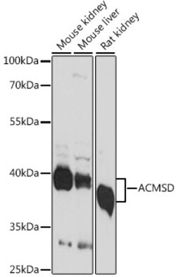 ABclonal Technology&nbsp;ACMSD Rabbit pAb