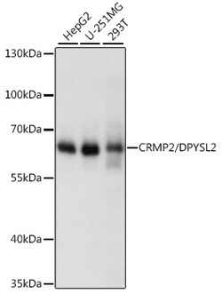 ABclonal Technology&nbsp;[KO Validated] CRMP2/DPYSL2 Rabbit pAb