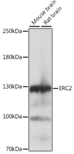 ABclonal Technology&nbsp;ERC2 Rabbit pAb
