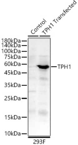 ABclonal Technology&nbsp;TPH1 Rabbit pAb