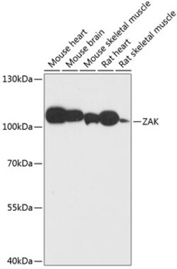 ABclonal Technology&nbsp;ZAK Rabbit pAb