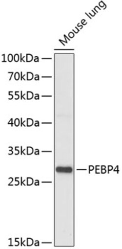 ABclonal Technology&nbsp;PEBP4 Rabbit pAb