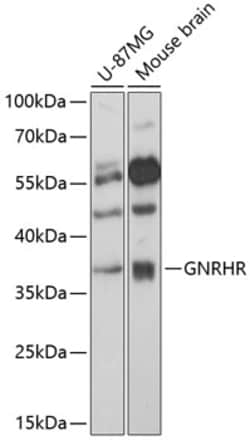 ABclonal Technology&nbsp;GNRHR Rabbit pAb