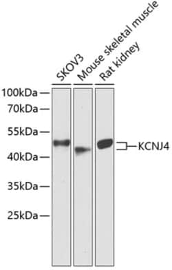 ABclonal Technology&nbsp;KCNJ4 Rabbit pAb