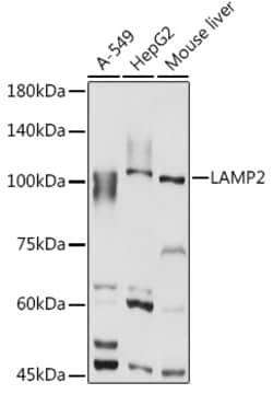 ABclonal Technology&nbsp;[KO Validated] LAMP2 Rabbit pAb