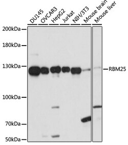 ABclonal Technology&nbsp;RBM25 Rabbit pAb