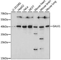 ABclonal Technology&nbsp;GALK1 Rabbit pAb