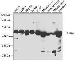 ABclonal Technology&nbsp;PHKG2 Rabbit pAb