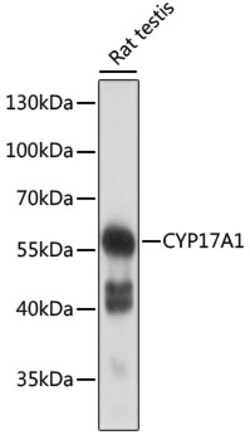 ABclonal Technology&nbsp;CYP17A1 Rabbit pAb