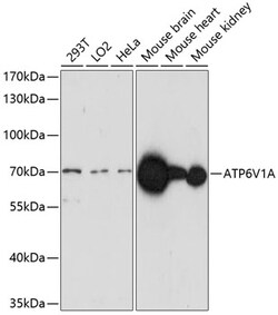 ABclonal Technology&nbsp;ATP6V1A Rabbit pAb