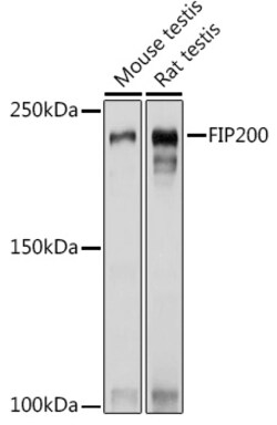 ABclonal Technology&nbsp;FIP200 Rabbit pAb