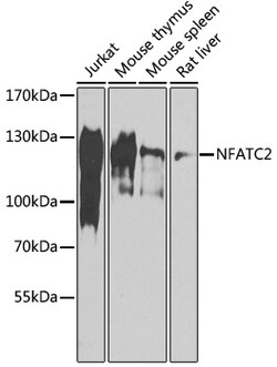 ABclonal Technology&nbsp;NFATC2 Rabbit pAb