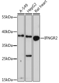 ABclonal Technology&nbsp;IFNGR2 Rabbit pAb