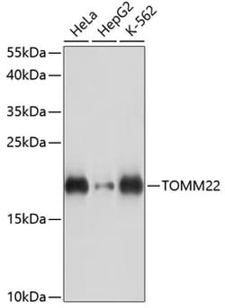 ABclonal Technology&nbsp;TOMM22 Rabbit pAb
