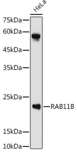 ABclonal Technology&nbsp;RAB11B Rabbit pAb